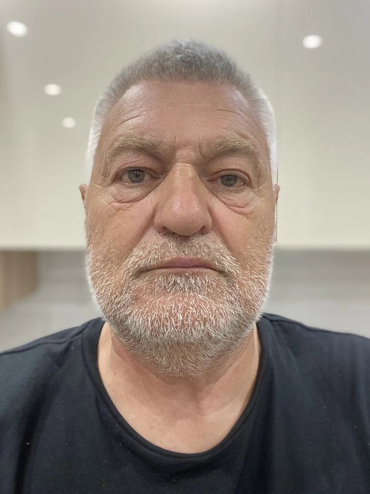 Carlos - 42 años